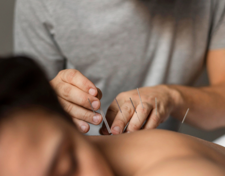 Comment-Choisir-un-Acupuncteur