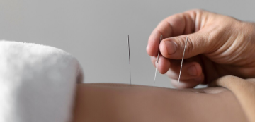 Les-Avantages-de-lAcupuncture-chez-Physiobalance-2